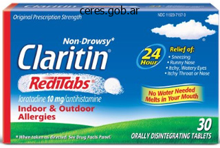 cheap loratadine 10 mg buy on line