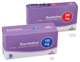 ranitidine 150 mg online